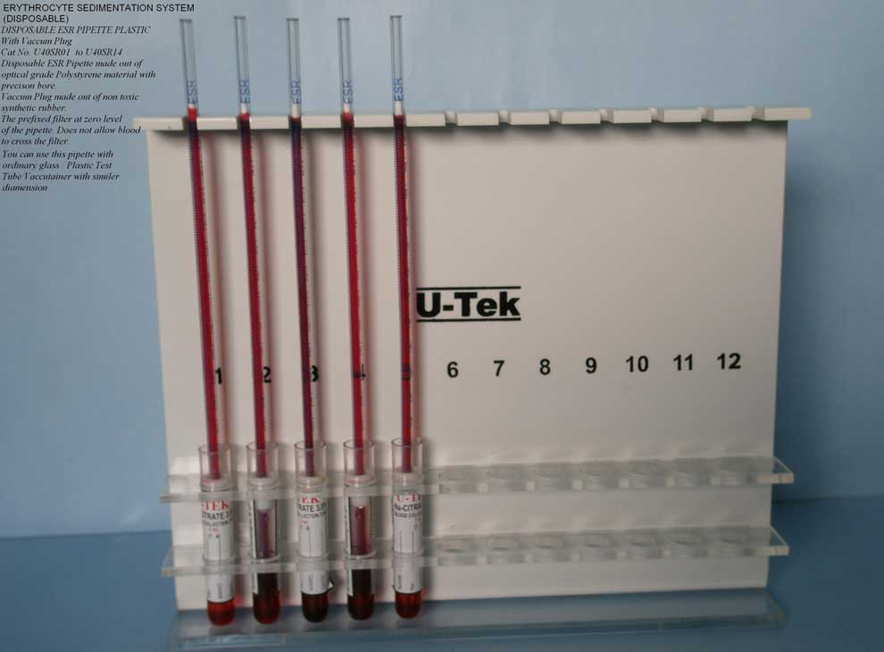 Disposable ESR Pipette with Vacuum Plug (U40SR06)
